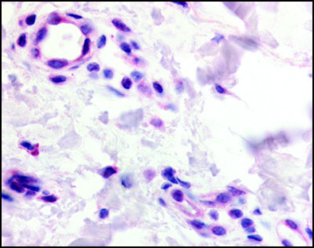 Anti-GPR2/CCR10 antibody produced in rabbit