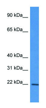 Anti-RPL12 (N-terminal) antibody produced in