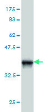 ANTI-PIM1 antibody produced in mouse