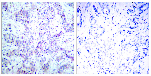Anti-RELA (Ab-536) antibody produced in