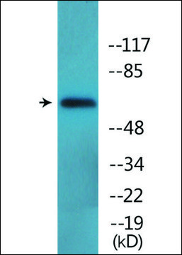 Anti-phospho-Moesin/Ezrin/Radixin (pThr???) antibody produced in