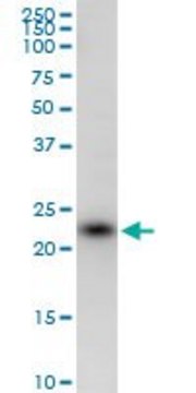 Anti-SSR2 antibody produced in mouse