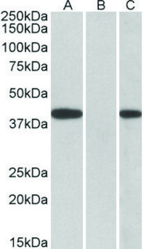 Anti-FANCF (C-terminal) antibody produced in