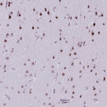 Anti-SS18 antibody produced in rabbit