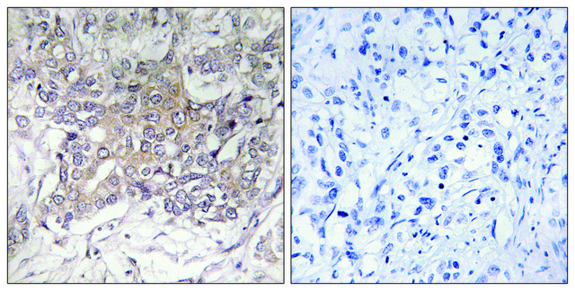 Anti-GCNT3 antibody produced in rabbit