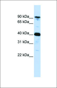 Anti-CARS antibody produced in rabbit