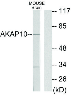 Anti-AKAP10 antibody produced in rabbit
