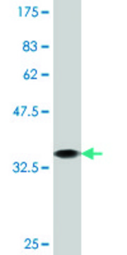 Monoclonal Anti-PCSK1, (C-terminal) antibody produced