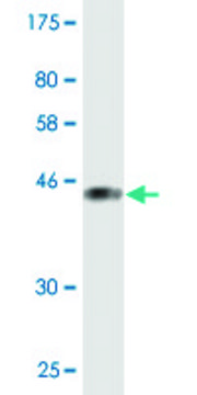 Monoclonal Anti-PIP5K1C, (C-terminal) antibody produced