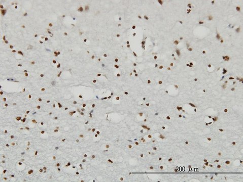 Monoclonal Anti-RPS6KA2 antibody produced in