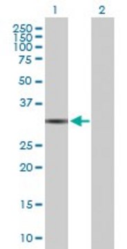 Anti-QPRT antibody produced in rabbit