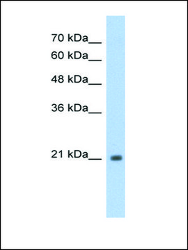 Anti-TSHR antibody produced in rabbit