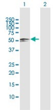 Anti-SARS2 antibody produced in rabbit