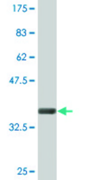 Monoclonal Anti-CLCN7, (C-terminal) antibody produced