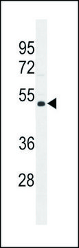 ANTI-NUDT19 (CENTER) antibody produced in