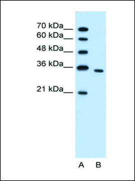 Anti-PRPS2 antibody produced in rabbit