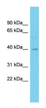 Anti-BCAT1 (N-terminal) antibody produced in