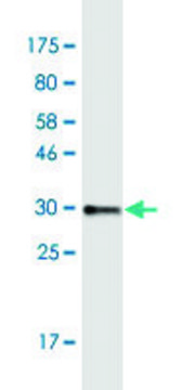 Monoclonal Anti-COL8A2 antibody produced in