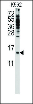 Anti-PFDN6 (C-term) antibody produced in