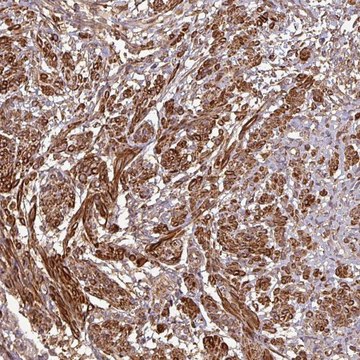 Anti-MAP3K6 antibody produced in rabbit