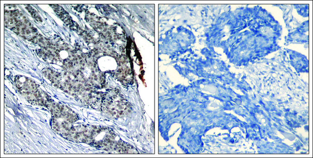 Anti-phospho-TP53 (pSer?) antibody produced in
