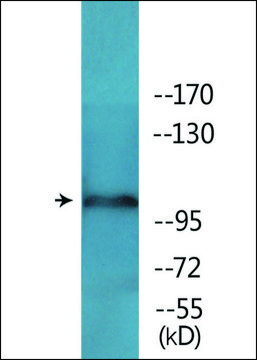 Anti-phospho-NMDAR1 (pSer???) antibody produced in