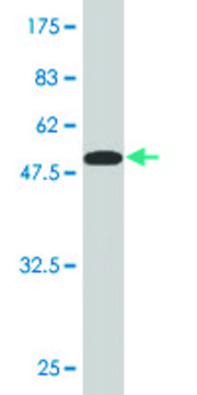 Monoclonal Anti-NT5E, (C-terminal) antibody produced