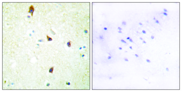 Anti-5-HT-2B antibody produced in rabbit