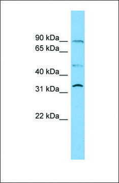 Anti-SLC27A3 antibody produced in rabbit