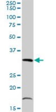 Anti-TIPIN antibody produced in rabbit