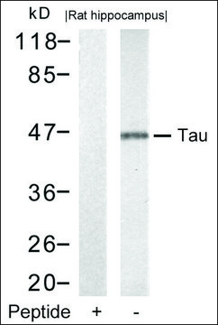 Anti-MAPT (Ab-212) antibody produced in