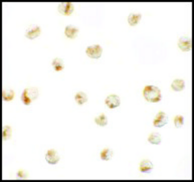 Anti-PRICKLE4 antibody produced in rabbit