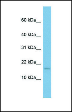 Anti-RPS13, (N-terminal) antibody produced in