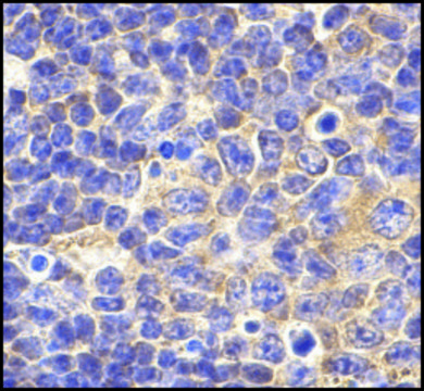 Anti-TLR1 (ab1) antibody produced in