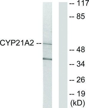 Anti-Cytochrome P450 21A2 antibody produced