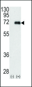 ANTI-PKC IOTA(N-TERMINAL) antibody produced in