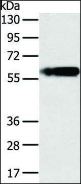 Anti-PLIN1 antibody produced in rabbit