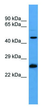 Anti-RAB8B (C-terminal) antibody produced in