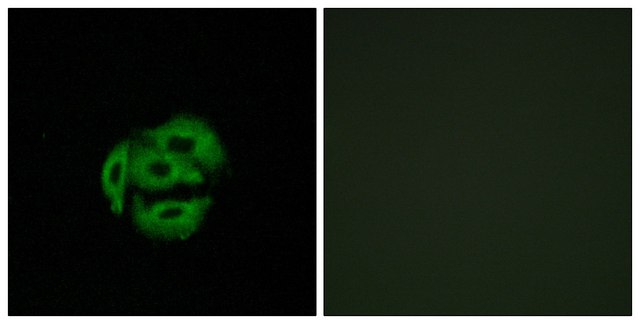 Anti-Cytochrome P450 39A1 antibody produced