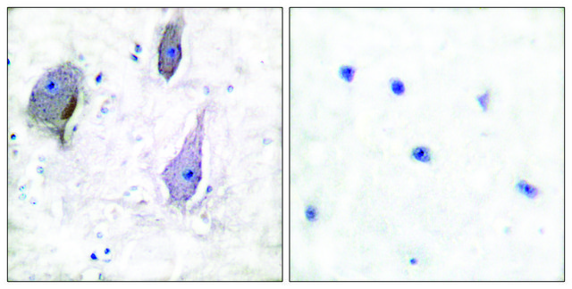 Anti-PMP22 antibody produced in rabbit