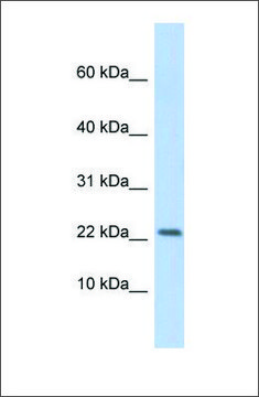 Anti-P2RX7 antibody produced in rabbit