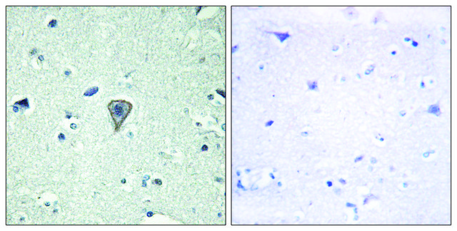 Anti-ETBR2 antibody produced in rabbit