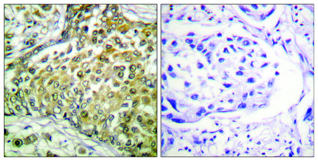 Anti-p53 (Acetyl-Lys³??), C-Terminal antibody produced