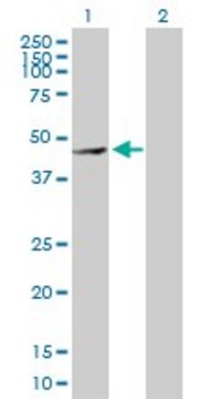 Anti-MMP28 antibody produced in rabbit