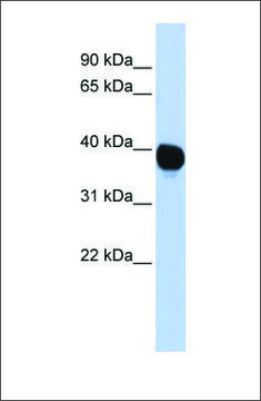 Anti-TPST2 antibody produced in rabbit