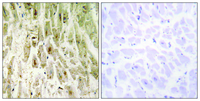Anti-SMAD1 antibody produced in rabbit