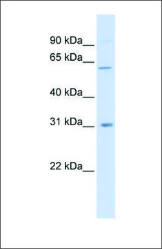 Anti-CHST2 antibody produced in rabbit