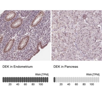 Anti-DEK antibody produced in rabbit