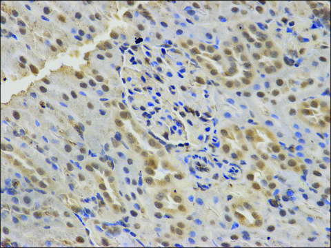 Anti-SMARCA4 antibody produced in rabbit