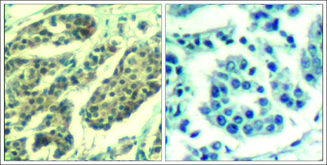 Anti-phospho-CCNB1 (pSer¹??) antibody produced in